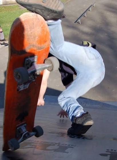 Skateboarding can be a dangerous activity with a high risk of injury, but the severity of these injuries can vary. • In 2022, an estimated 230,000 people were treated in emergency 
