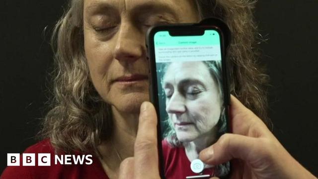 A woman with shoulder length grey hair and a red top closes her eyes as a medical photographer leans in to take a picture of her skin, using a mobile phone that has special equipment and an app on it