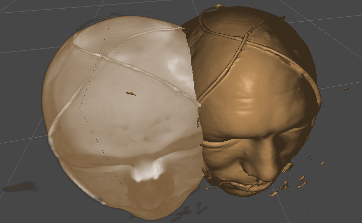 Unity Volume Rendering (@unityvolrend@fosstodon.org) - Fosstodon
